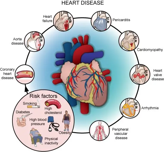 Risk factors for heart problems, cardiovascular diseases (angina and heart attack)