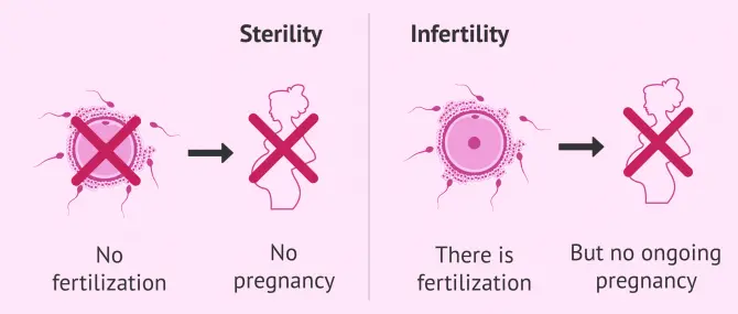 Risk factors for infertility (sterility)