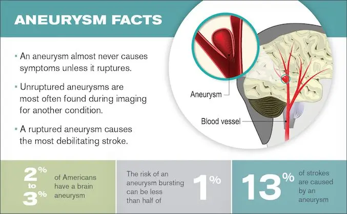 Ruptured Aneurysm &#8211; Definition, Symptoms and Treatments