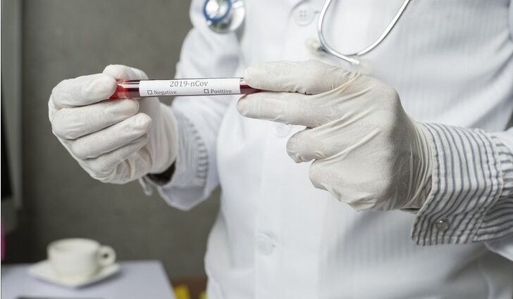 Russia has created a high-precision test for the diagnosis of coronavirus