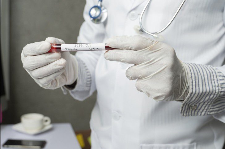 Russia has created a high-precision test for the diagnosis of coronavirus