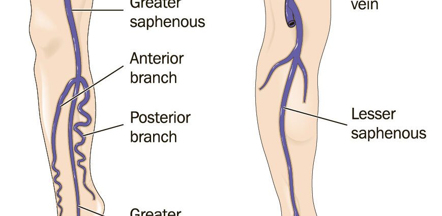 Saphenous veins: what are they used for?