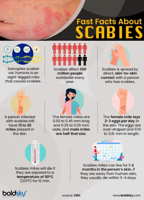 Scabies: symptoms and treatment of scabies