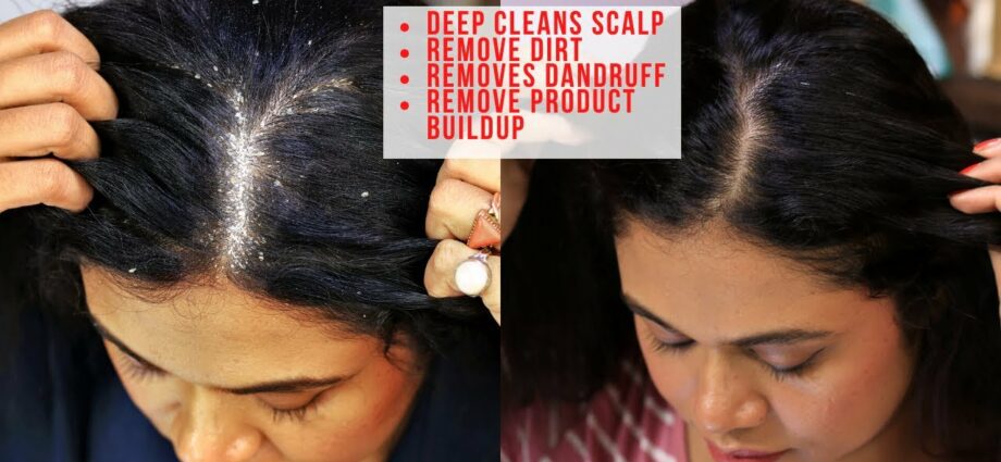 Scalp peeling at home. Video