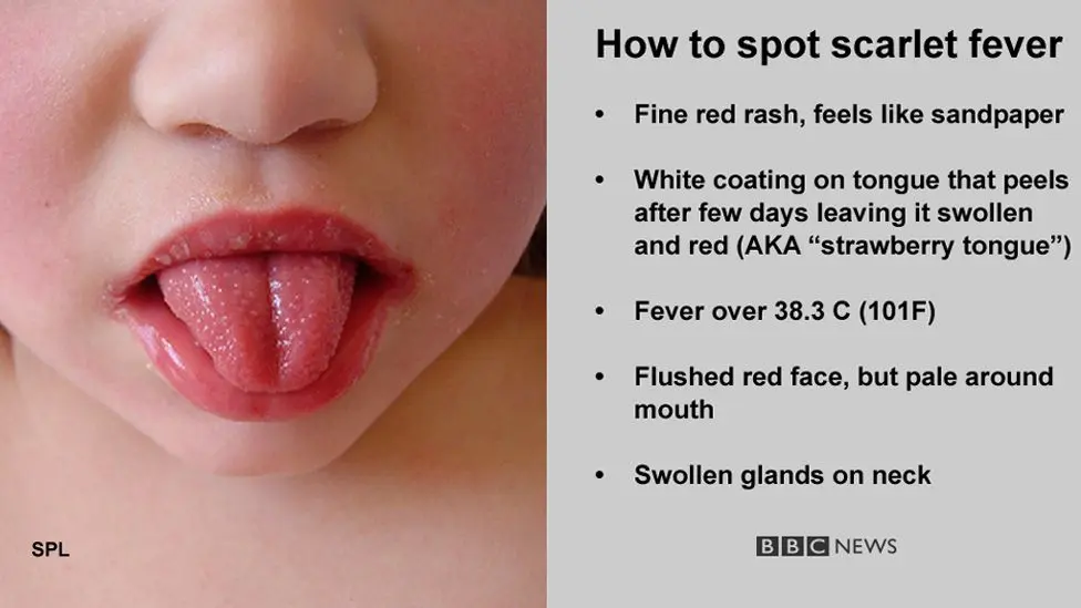 Scarlet fever: what is it?