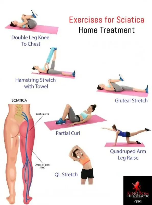 Sciatica: treatment and prevention