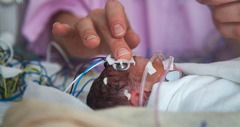 Scientists have found another consequence of premature birth