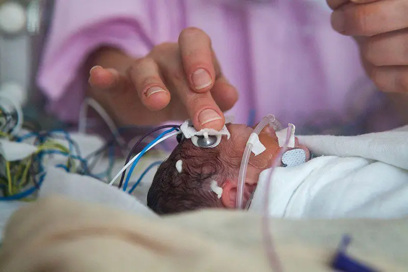 Scientists have found another consequence of premature birth