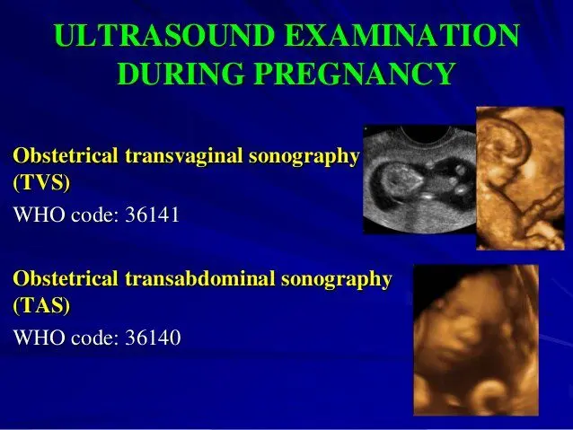 Screenings and ultrasound during pregnancy