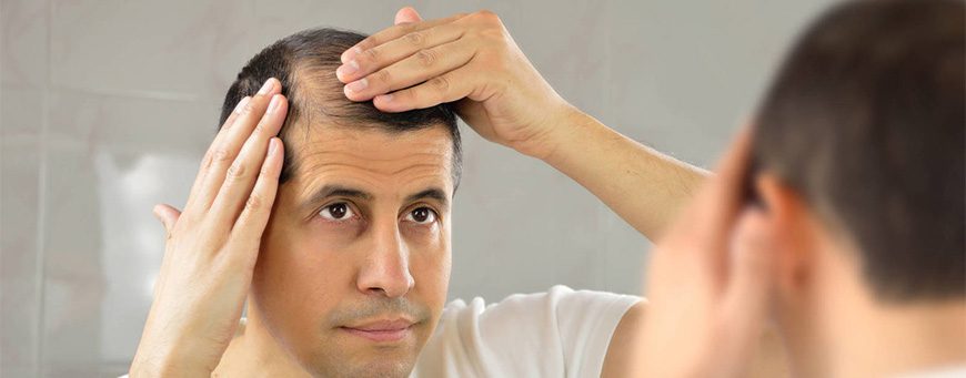 Seasonal hair loss: how to avoid it?