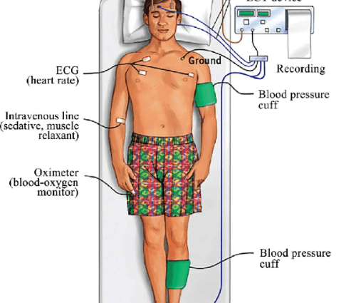 Seismotherapy