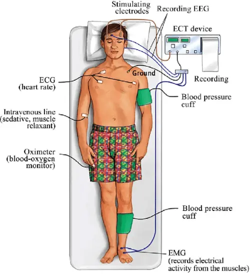 Seismotherapy