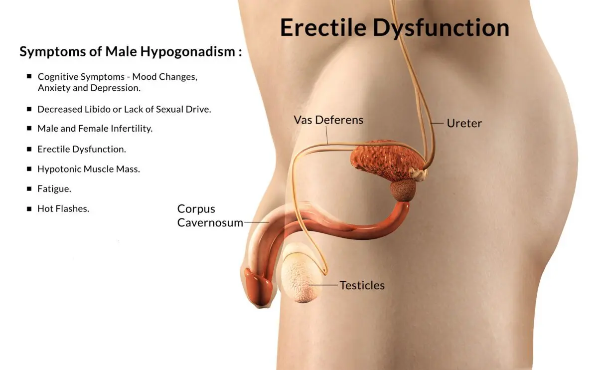 Sex Erectile dysfunction