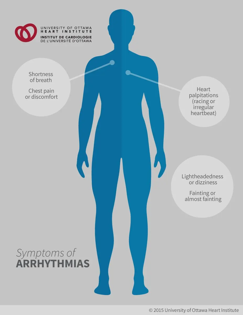 Shortness of breath, weakness, arrhythmia: how to get rid of the consequences of COVID-19