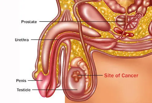 Sites of interest for testicular cancer