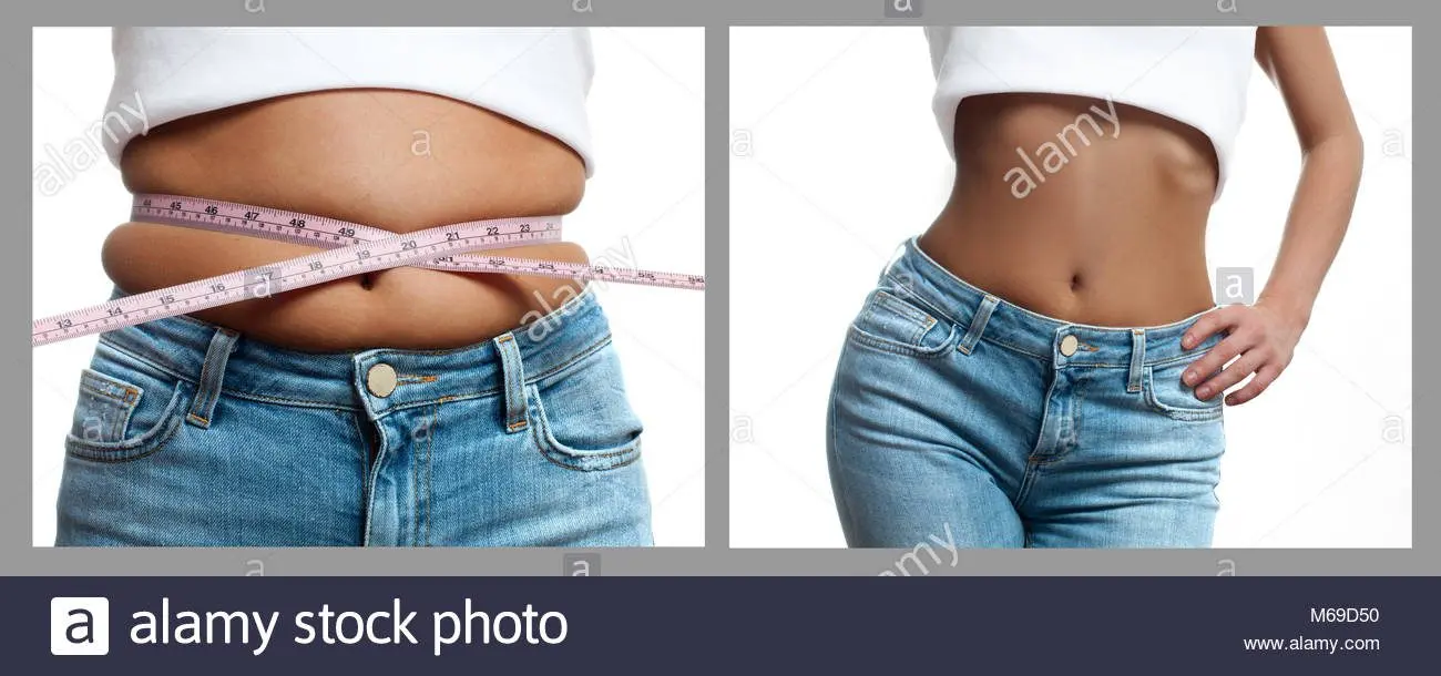 Slimming before and after