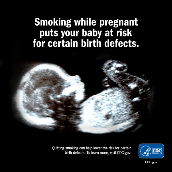 Smoking during pregnancy