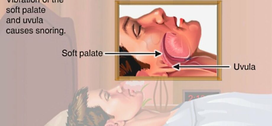 Snoring is harmful to health. Video