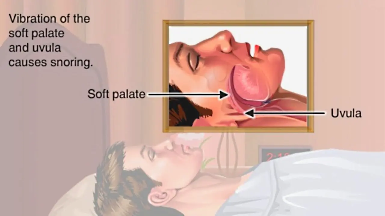 Snoring is harmful to health. Video