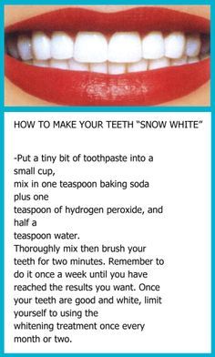 snow-white smile, how to whiten your teeth correctly, whiten your teeth at home