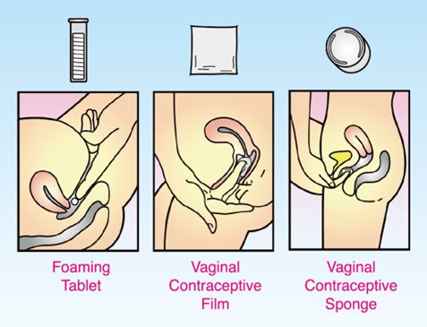 Spermicide