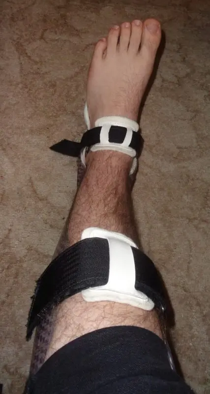 Splint: what is this device for, how to use it?