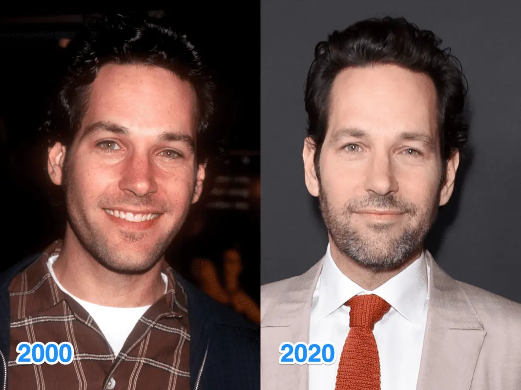 Stars who began to look bad: photos before and after 2018