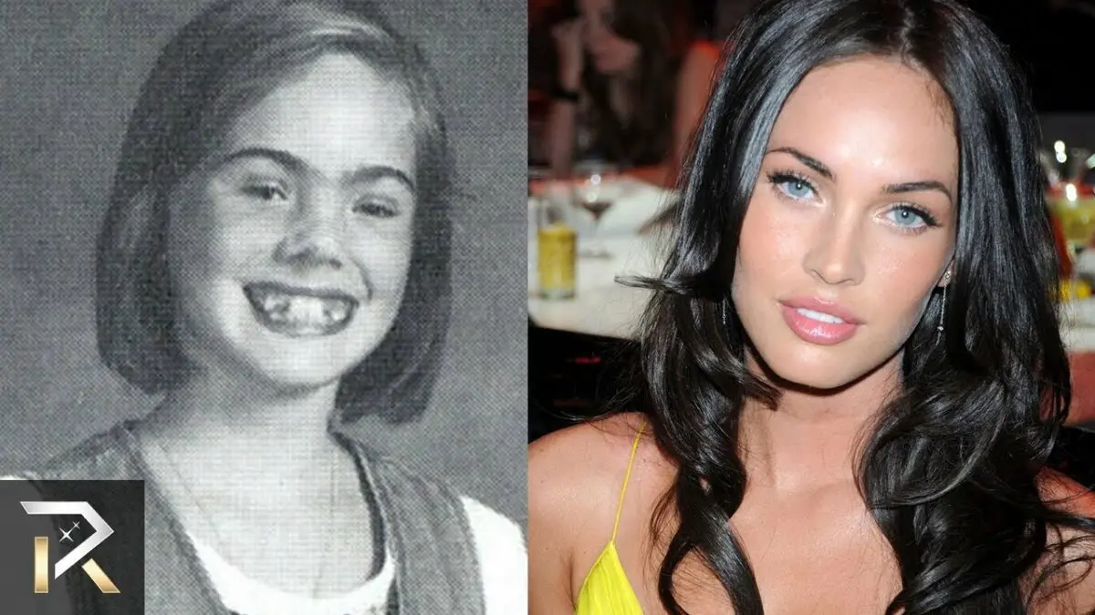 Stars who were ugly in childhood photos