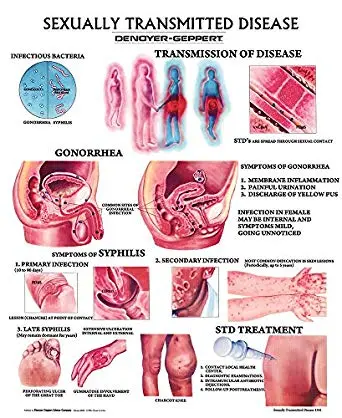 STDs and STIs: all about sexually transmitted diseases and infections