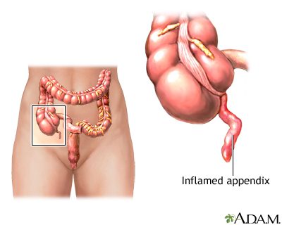 Stomach ache: where does it come from?