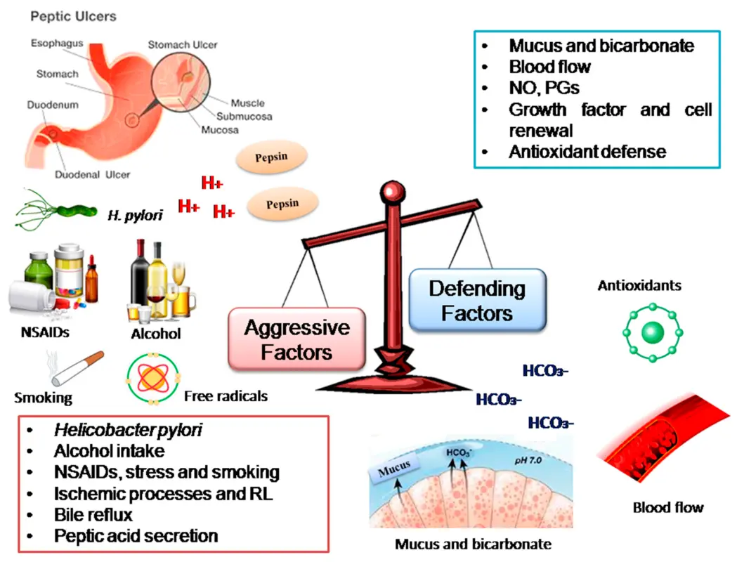 Stomach ulcer and duodenal ulcer: complementary approaches