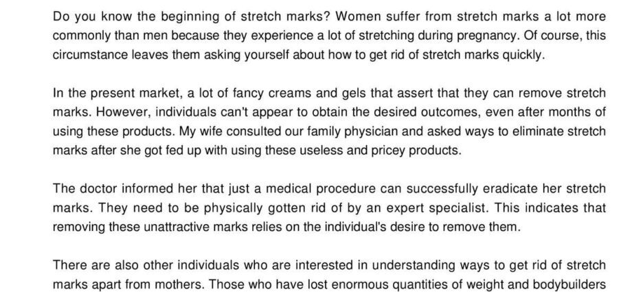 Stretch marks &#8211; Our doctor&#8217;s opinion