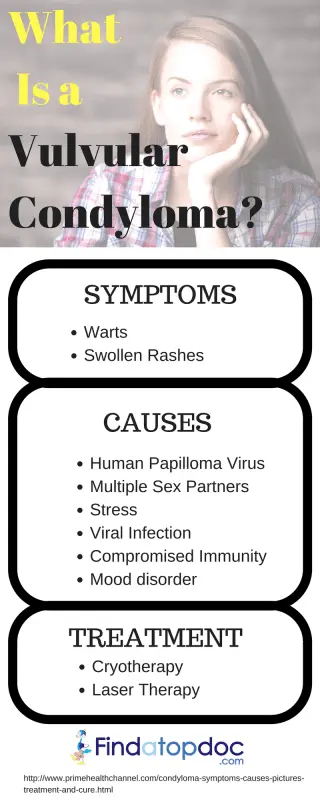 Symptoms and people at risk of condyloma (genital warts)