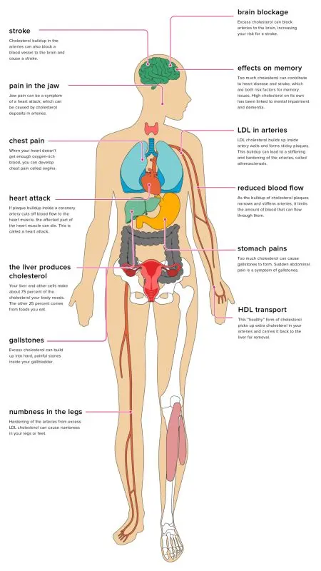 Symptoms and people at risk of hyperlipidemia (Cholesterol and triglycerides).