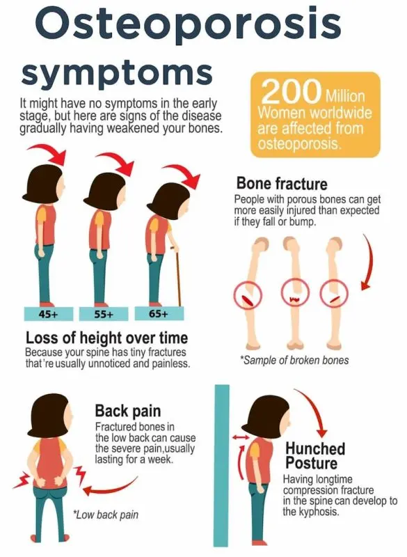 Symptoms and people at risk of osteoporosis