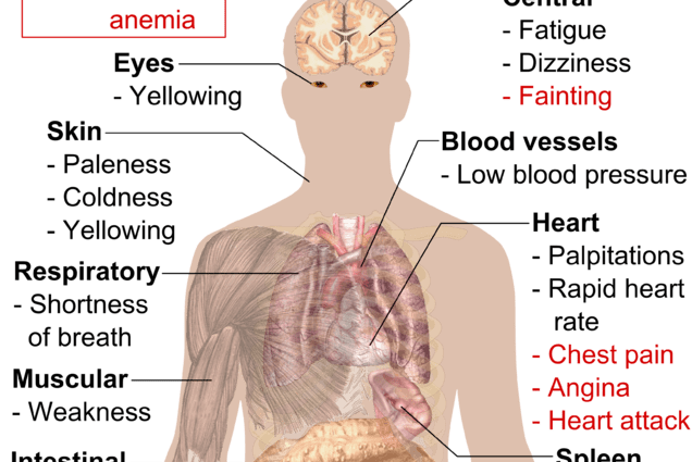 Συμπτώματα αναιμίας