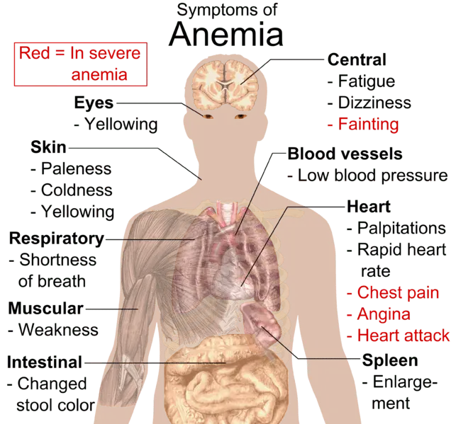 Symptoms of anemia