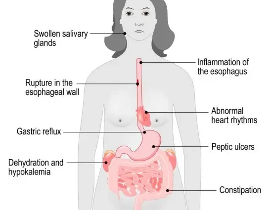 Symptoms of bulimia