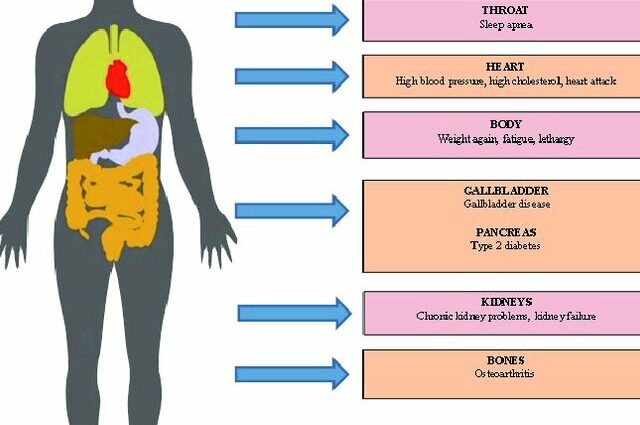 Söömishäirete sümptomid (anoreksia, buliimia, liigsöömine)