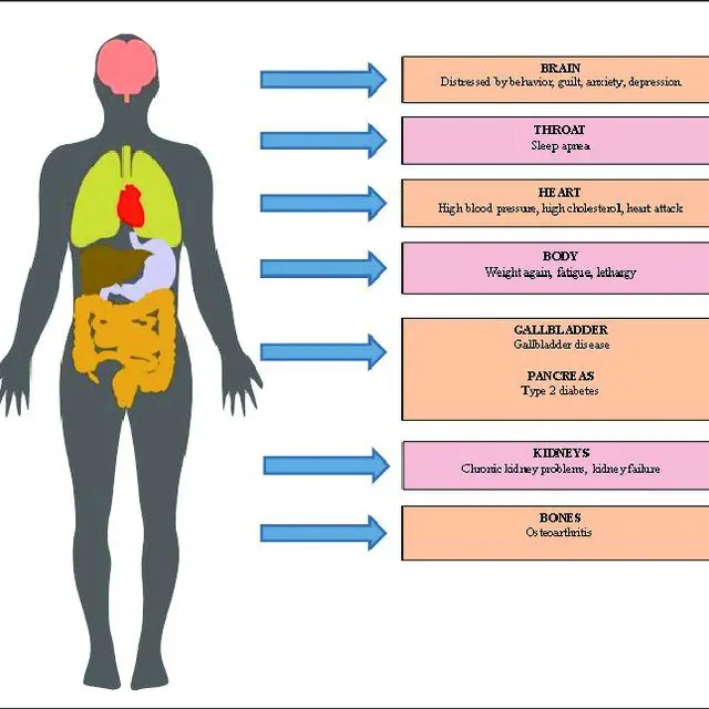 Symptoms of eating disorders (anorexia, bulimia, binge eating)
