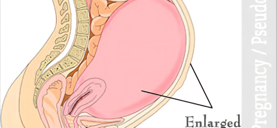 Symptoms of false pregnancy in women. For what reasons there is a false pregnancy