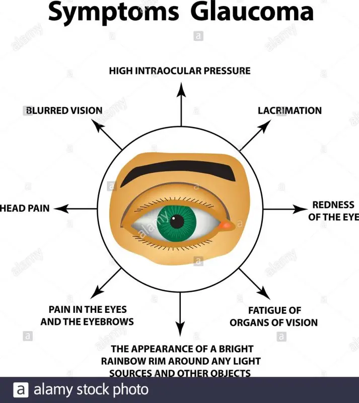 Symptoms of glaucoma