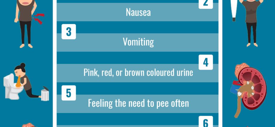 Böyrək daşlarının simptomları (böyrək daşları)
