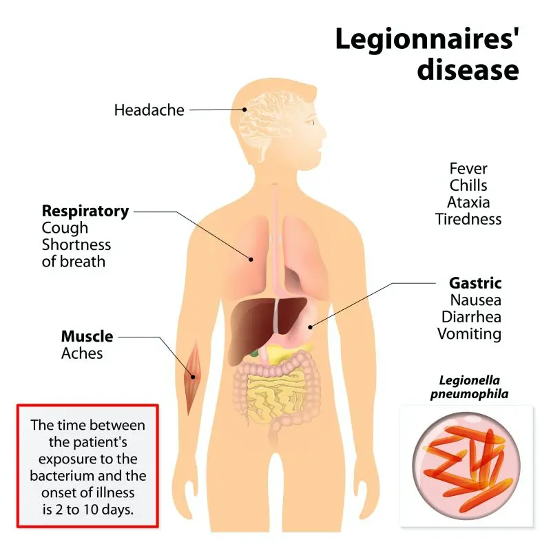 Symptoms of legionellosis (Legionnaires&#8217; disease)