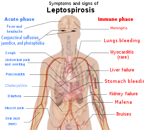 Symtom på leptospiros