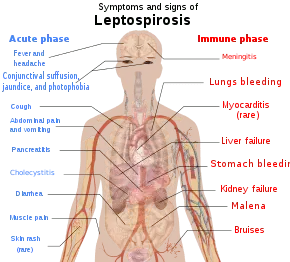 Symptoms of leptospirosis