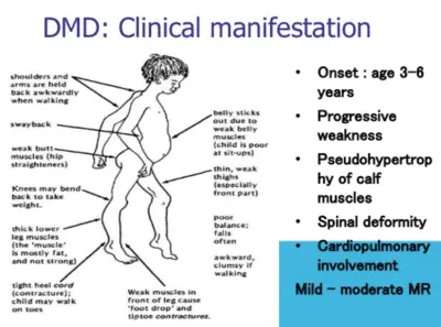 Symptoms of myopathy