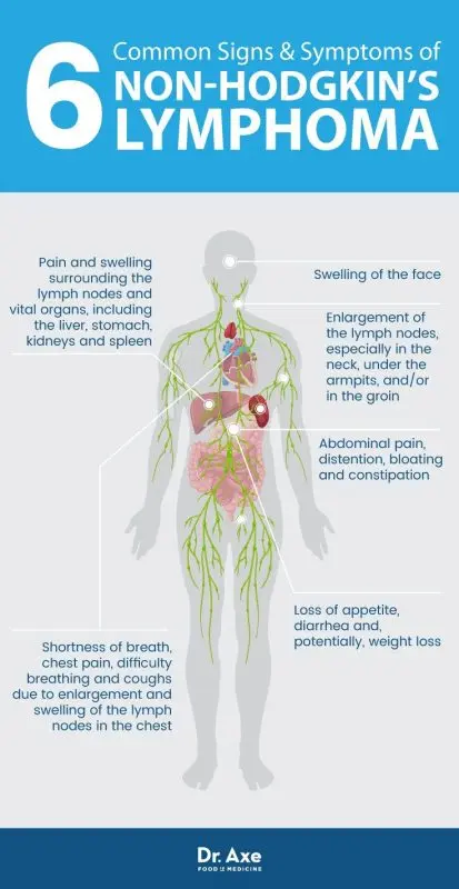 Symptoms of non-Hodgkin lymphoma