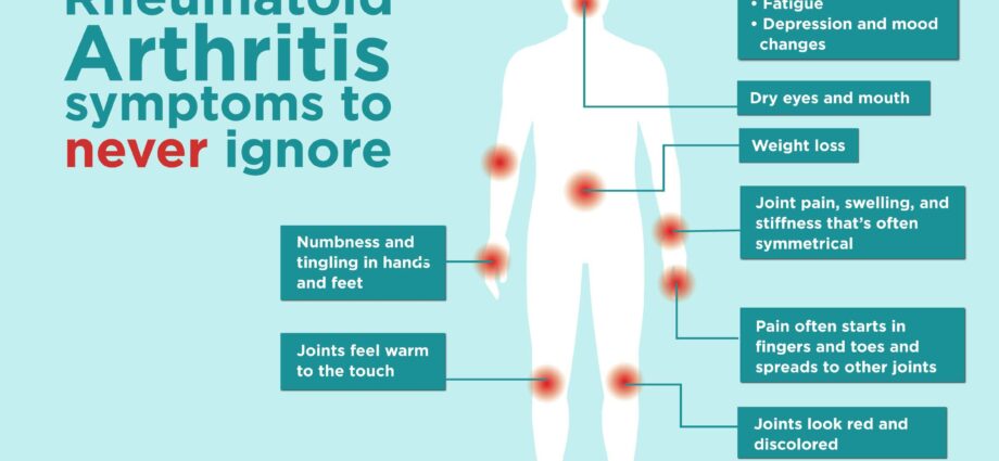 Symptomen van reumatoïde artritis (reuma, artritis)