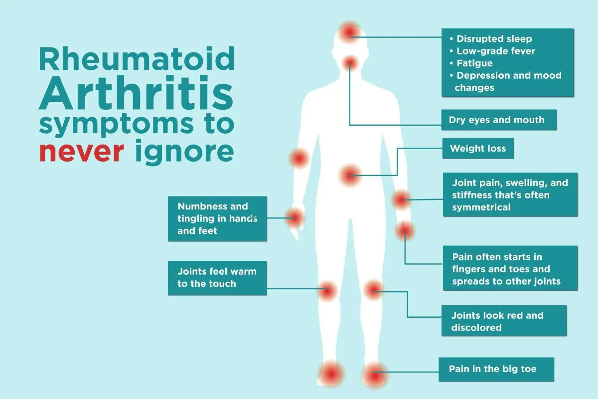 Symptoms of rheumatoid arthritis (rheumatism, arthritis)